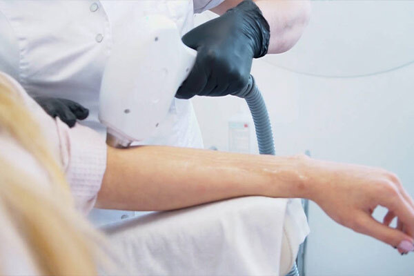 什么是強脈沖光（IPL）